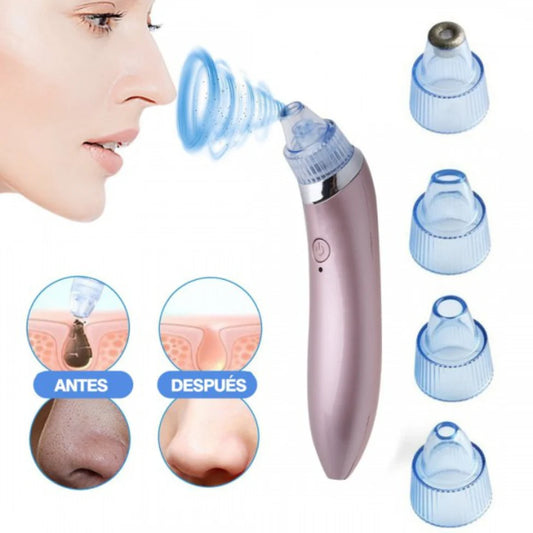 💎 Extractor Profesional de Espinillas y Puntos Negros
